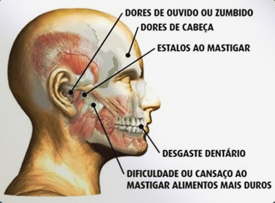 Bruxismo está ligado ao estresse e também a ansiedade