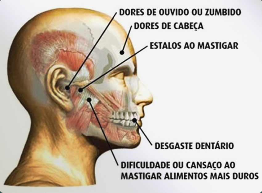 Bem Estar - Estalos, zumbido, dor de cabeça e na face são sinais